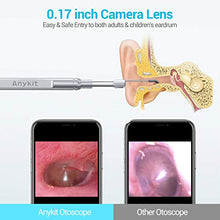 Load image into Gallery viewer, Anykit Ear Wax Removal Tool, HD Otoscope Ear Cleaner for iPhone &amp; Android, Ultra Clear View Ear Camera with Ear Wax Remover, Ear Endoscope with LED Lights, Ear Cleaning Camera with Ear Spoon
